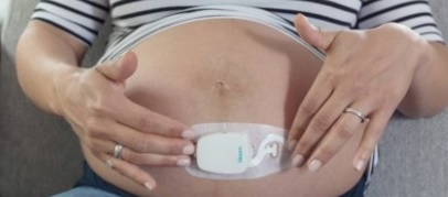Bloomlife : la start-up liégeoise qui brille