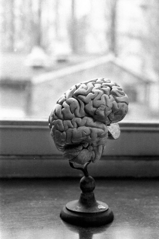 C’est la semaine du cerveau à l’Université de Liège