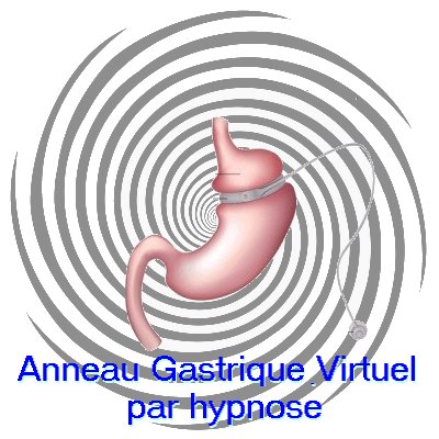 Agenda ► Anneau gastrique virtuel par hypnose