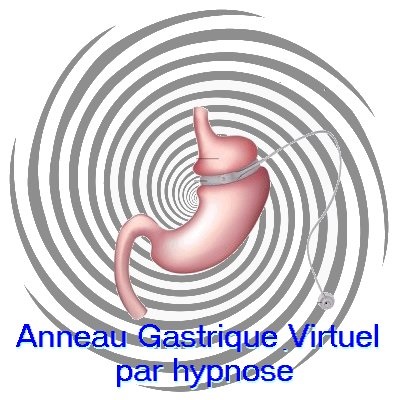 Agenda ► Anneau gastrique virtuel par hypnose – Maigrir – Liège