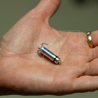 Le plus petit stimulateur cardiaque au monde implanté avec succès au CHR