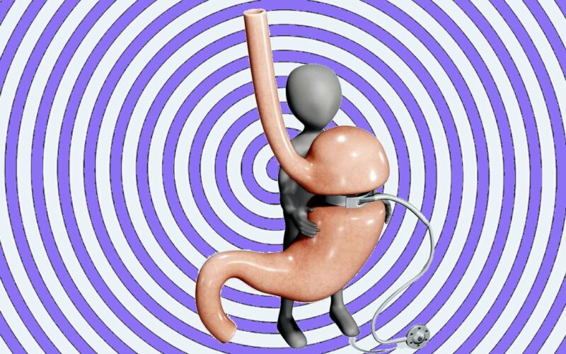 Agenda ► Anneau gastrique virtuel pour maigrir par auto-hypnose
