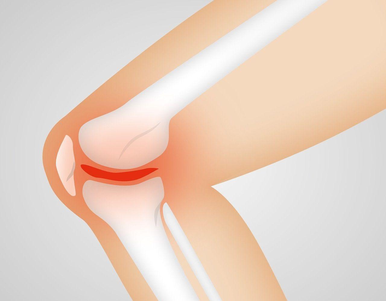 L’hôpital de la Citadelle propose une technique innovante pour soulager l’arthrose du genou